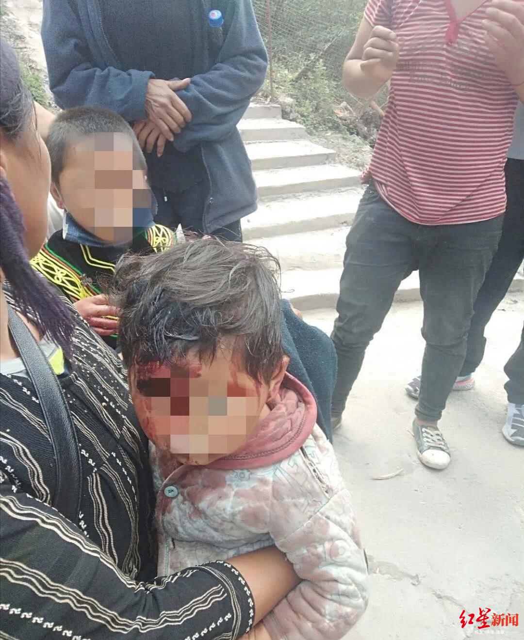 凉山一野猴进村咬伤两儿童，此前也有小孩被咬伤