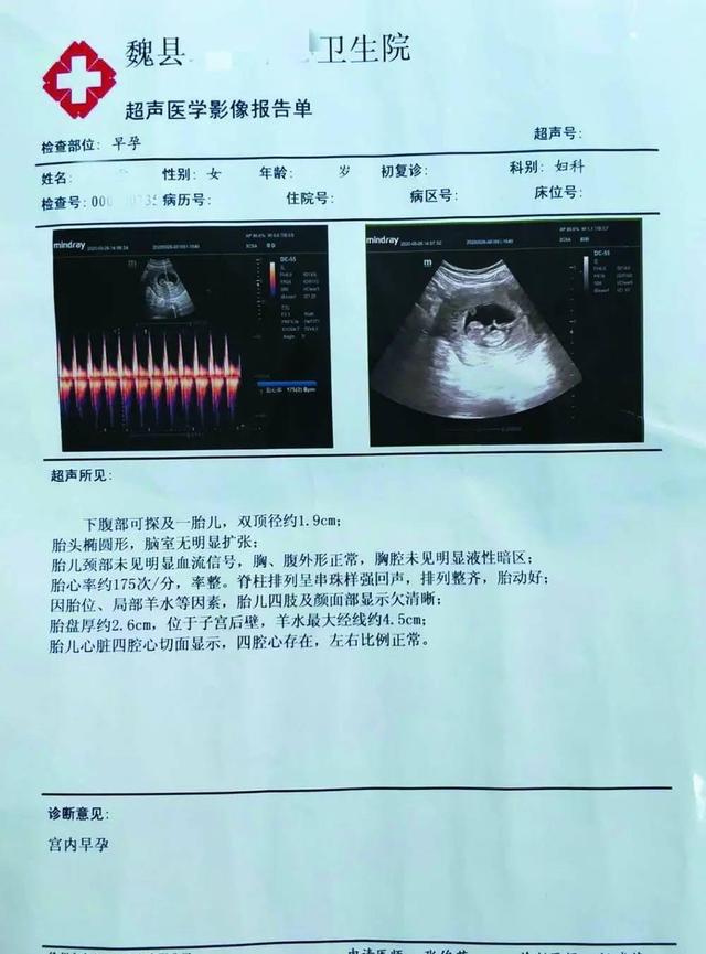 精神病女患者住院期怀孕,医院:护工干的,没大责任