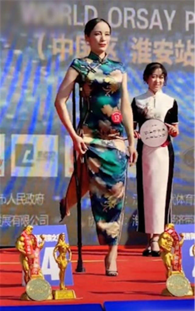 独腿姑娘健美比赛夺冠曾是跳高运动员担任北京奥运火炬手