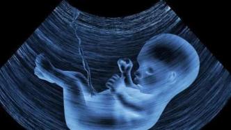 外媒：人类胎盘首现微塑料颗粒，婴儿或成生物和无机物混合体