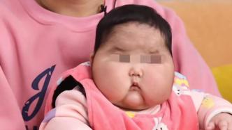 漳州回应“婴儿用抑菌霜成大头娃娃”：责令召回涉事产品