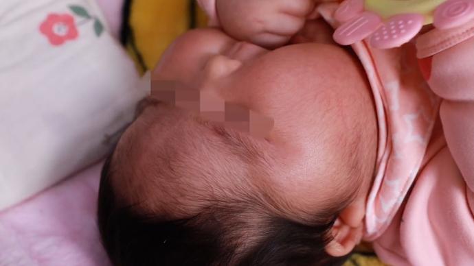 家属质疑抑菌霜激素超标致大脸娃娃公司删除0激素声明