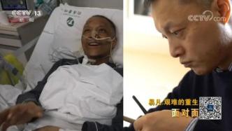 回访｜武汉“黑脸医生”易凡的重生之路：争取早日回到手术台