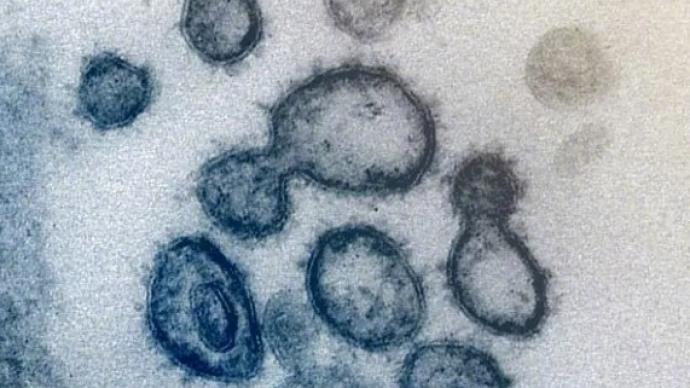 世卫组织：第二年疫情形势可能更为严峻