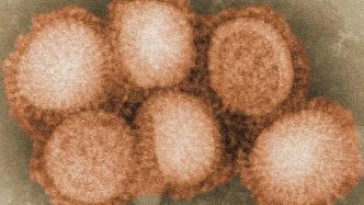 国家自然基金重大研究计划项目资助冠状病毒宿主免疫机制研究