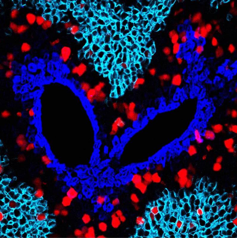图中红色信号即是新生的肝细胞，集中在肝小叶的中间区。