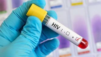 新研究：刚果（金）4%艾滋患者能自然抑制病毒且不需服药
