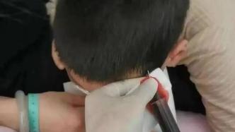 警方通报“男孩被体罚皮骨分离”：伤情为轻伤，教师被刑拘