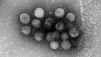 研究新发现两种可能传人的冠状病毒，一种类似于犬类冠状病毒