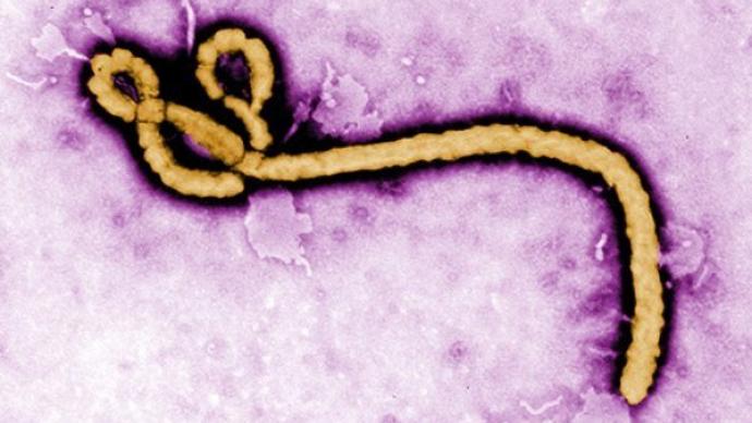 美国德堡生物实验室暗史：埃博拉病毒泄漏惊魂