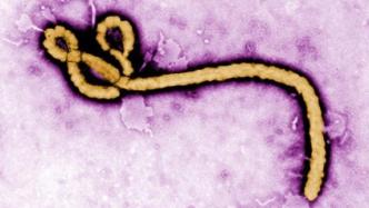 美国德堡生物实验室暗史：埃博拉病毒泄漏惊魂