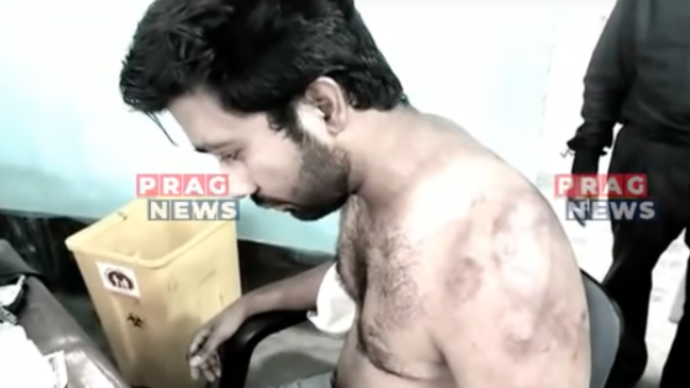 印度再现恶性袭医案：24人殴打一名医生