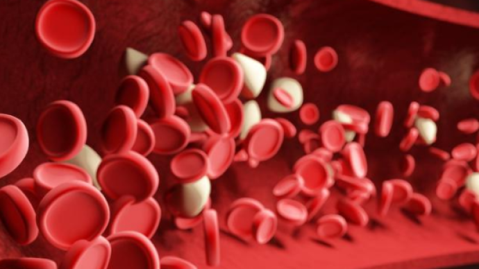 德国科学家研究发现：感染新冠病毒会改变血细胞大小和硬度