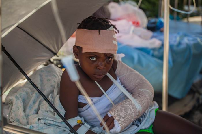 一名受伤儿童在海地莱凯接受治疗。