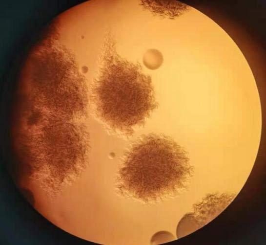 低倍显微镜下的炭疽芽胞杆菌菌落形态。图片源自中疾控官网