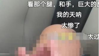 学生称工厂实习时手指致残后续治疗无人理，湖南临武：正处理