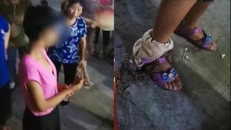 重庆一女孩脚戴铁链，官方：因偷窃被父亲锁住，将协调返校