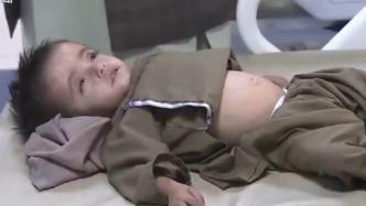联合国警告：百万阿富汗儿童或将面临饥饿和死亡