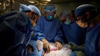世界首例！美国医生将猪肾移植入人体，未立即引发排异反应