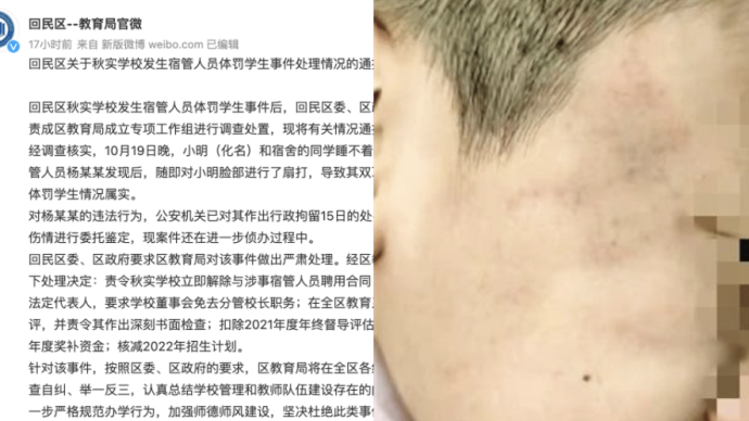 呼和浩特一學校宿管員扇打學生致雙耳鼓膜穿孔,分管校長被免