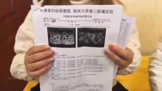 郑州怀八胞胎女子年仅18岁，其家属确认曾打过促排卵针