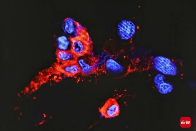 免疫荧光图像检测变种病毒的NP蛋白24小时感染组。香港大学供图