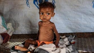 早安·世界｜也门面临严重饥荒，孩童骨瘦如柴令人心碎