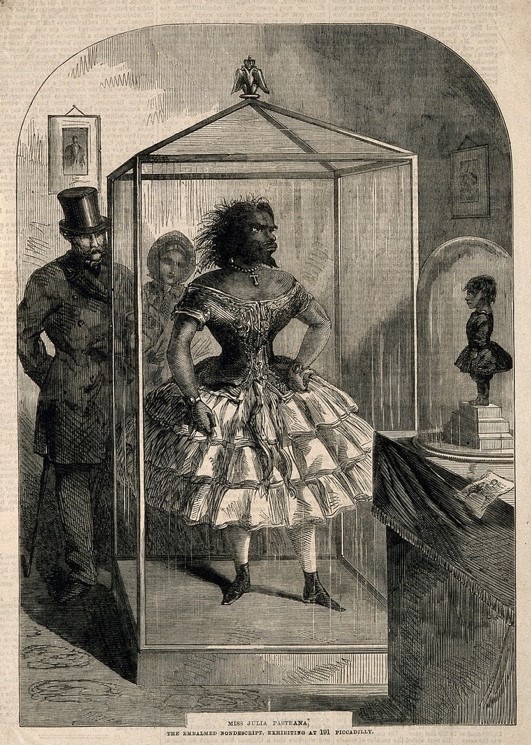 茱莉娅及其孩子的身体标本（Julia Pastrana and her son embalmed, The Penny Illustrated Paper, London, 1862）