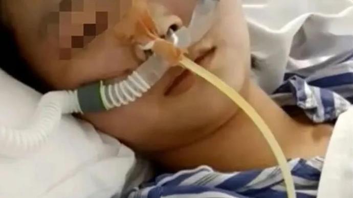 被姐夫投毒女孩完成肺移植手术，“已经醒了，生命体征平稳”