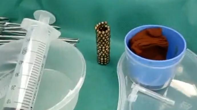 13岁男孩因好奇往尿道塞186颗巴克球，第二日尿中带血