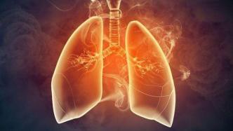 科学家发现肺部可再生新细胞，为治疗慢性肺病开辟新方向