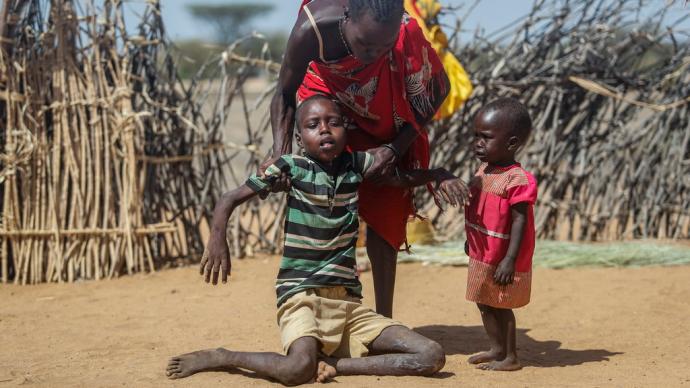早安·世界｜非洲严重干旱:数百万孩童面临营养不良问题