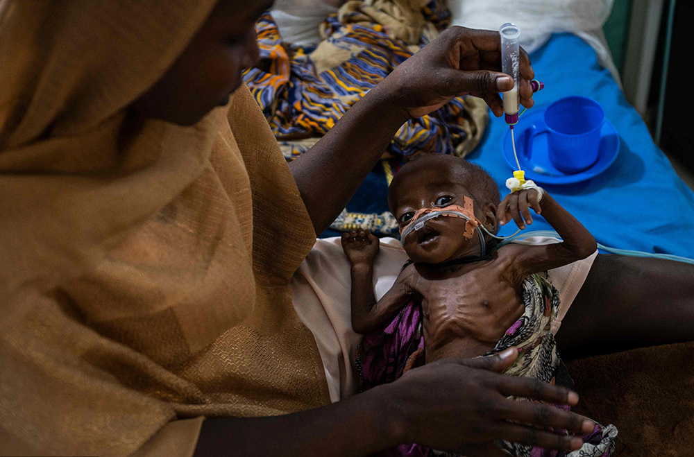 当地时间2022年5月13日，乍得恩贾梅纳，一名营养不良的儿童在当地医院接受治疗。