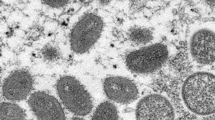 华山刊文：欧美出现罕见的猴痘疫情，我们应该担心吗？