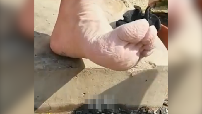 消防员灭火后，双脚被水泡得起皱发白