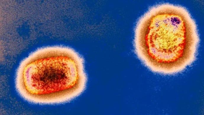 德国新增2例猴痘确诊病例，疾控机构认为不会出现大流行