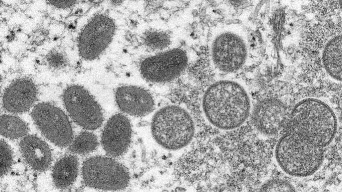 英国猴痘确诊病例增至57例
