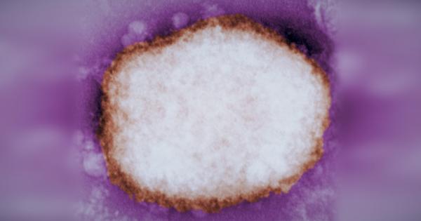 这张高度放大的电子显微镜图像显示了桑葚型的猴痘病毒颗粒