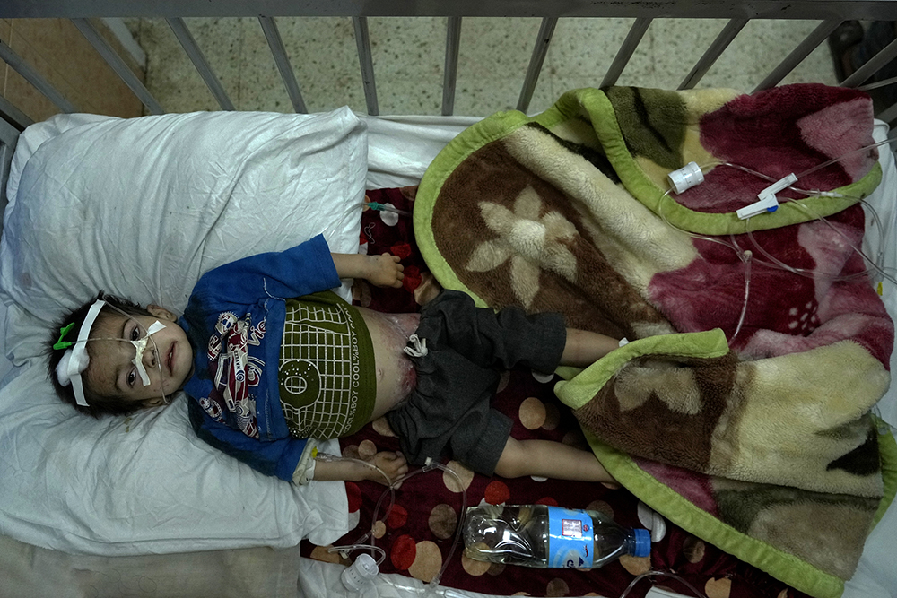 当地时间2022年5月18日，阿富汗喀布尔，一名严重急性营养不良的男孩躺在医院接受治疗。