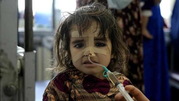 早安·世界｜110萬阿富汗兒童可能面臨嚴重營養不良
