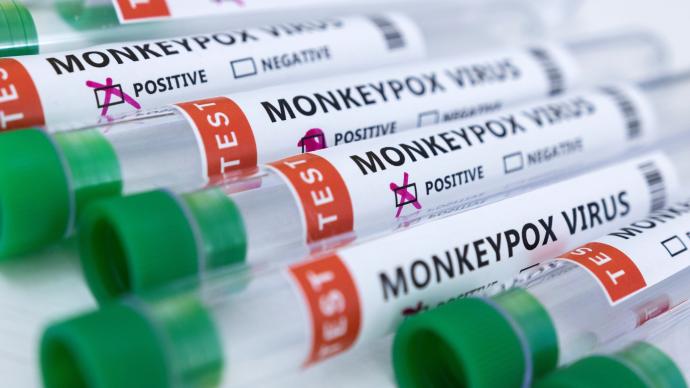 “跳出”非洲的猴痘会在全球蔓延吗？专家：需监测但不用恐慌