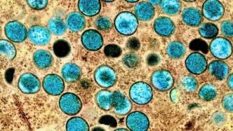 美国猴痘病毒基因组惊现第二分支：至少两波疫情正同时发生