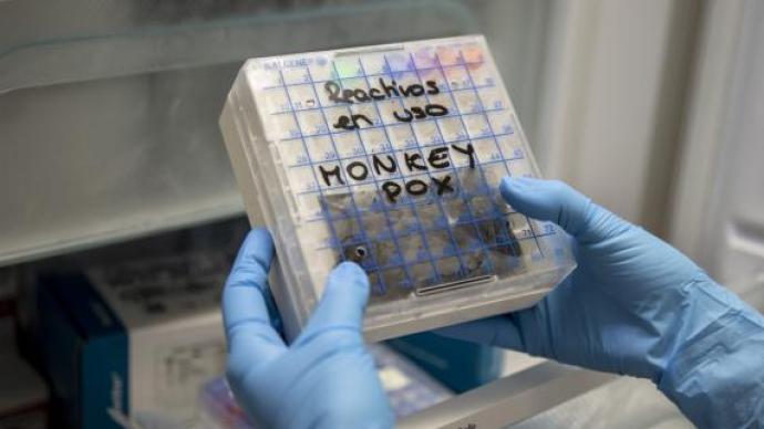 传染病专家担忧美国猴痘疫情防控：现有检测政策将造成延误