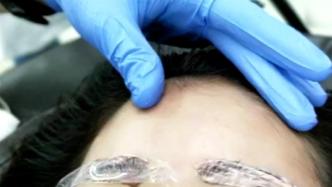 女子疑因纹眉感染乙肝，医生表示器械未严格消毒可能传染