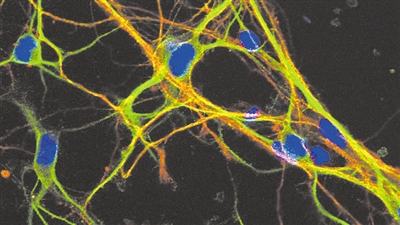 表达轴突标记TAU（绿色）和树突标记MAP-2（红色）的分化皮层神经元。 图片来源：巴斯大学罗伯特·威廉姆斯