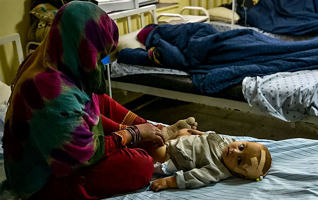 当地时间2022年6月22日，阿富汗帕克提卡省，受伤的孩子在医院接受治疗。