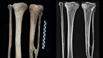 以骨释人，寻骨觅踪：2021年人类骨骼考古盘点