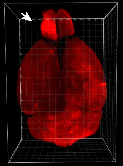 代表性肿瘤大脑透明化图 红色聚团处为肿瘤