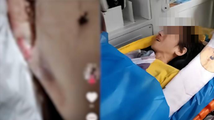 六盘水水城区通报抗癌网红“小敏”事件：她正在医院接受治疗