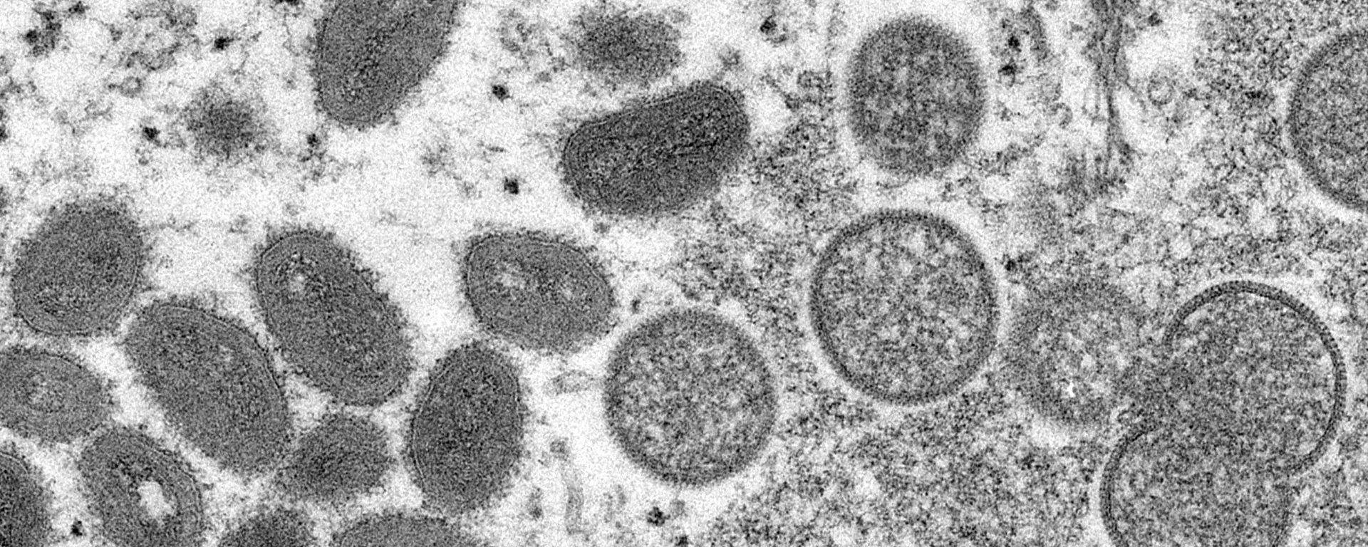 电子显微镜下的猴痘病毒。 资料图